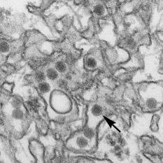 In this transmission electron micrograph of Zika virus, the arrow indicates a single virus particle. Courtesy: U.S. Centers for Disease Control and Prevention.